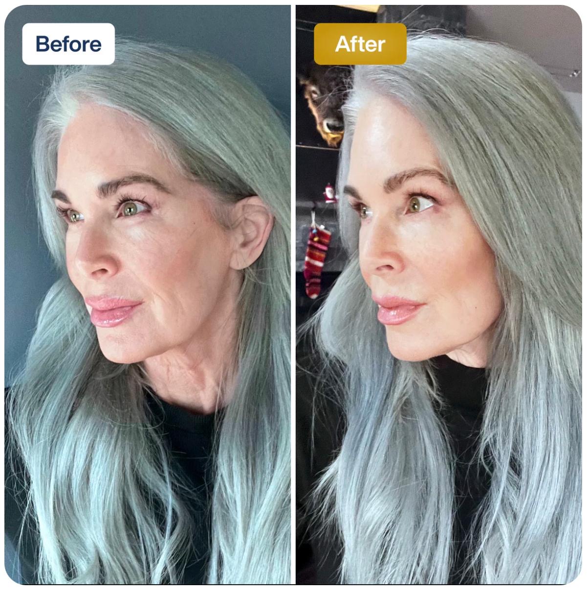 Skin glow and texture transformation